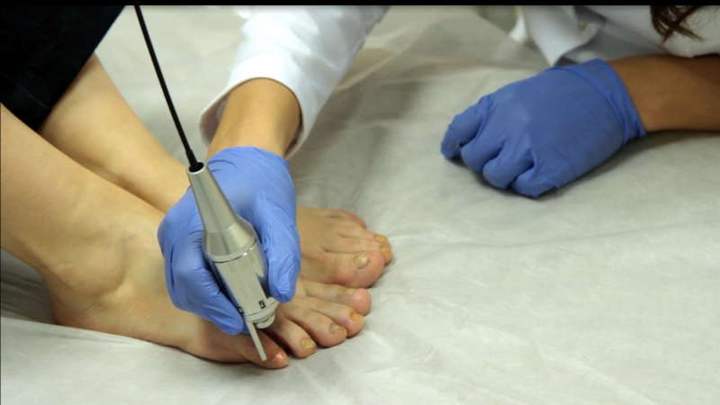 Грибок ногтей: методы лечения