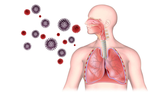 Вирусные инфекции верхних дыхательных путей: способы лечения