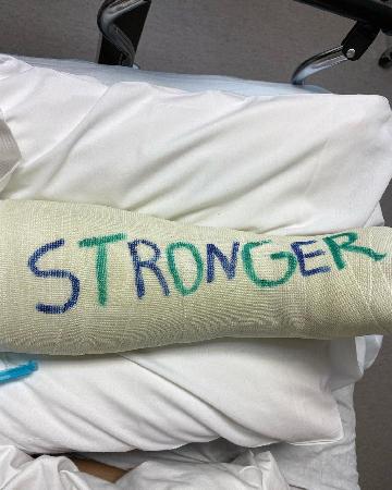 Бритни Спирс попала в больницу: певица сломала ногу